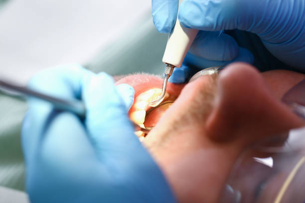 Best Emergency Dentist for Knocked-Out Tooth in Victory Gardens, NJ